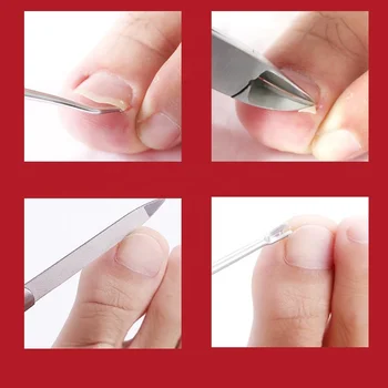 Нож за нокти от тежка стомана За Врастнали Нокти, Кожички Инструменти за Подстригване на Кожичките Нокти Ножици, нокторезачки за Дебели Нокти